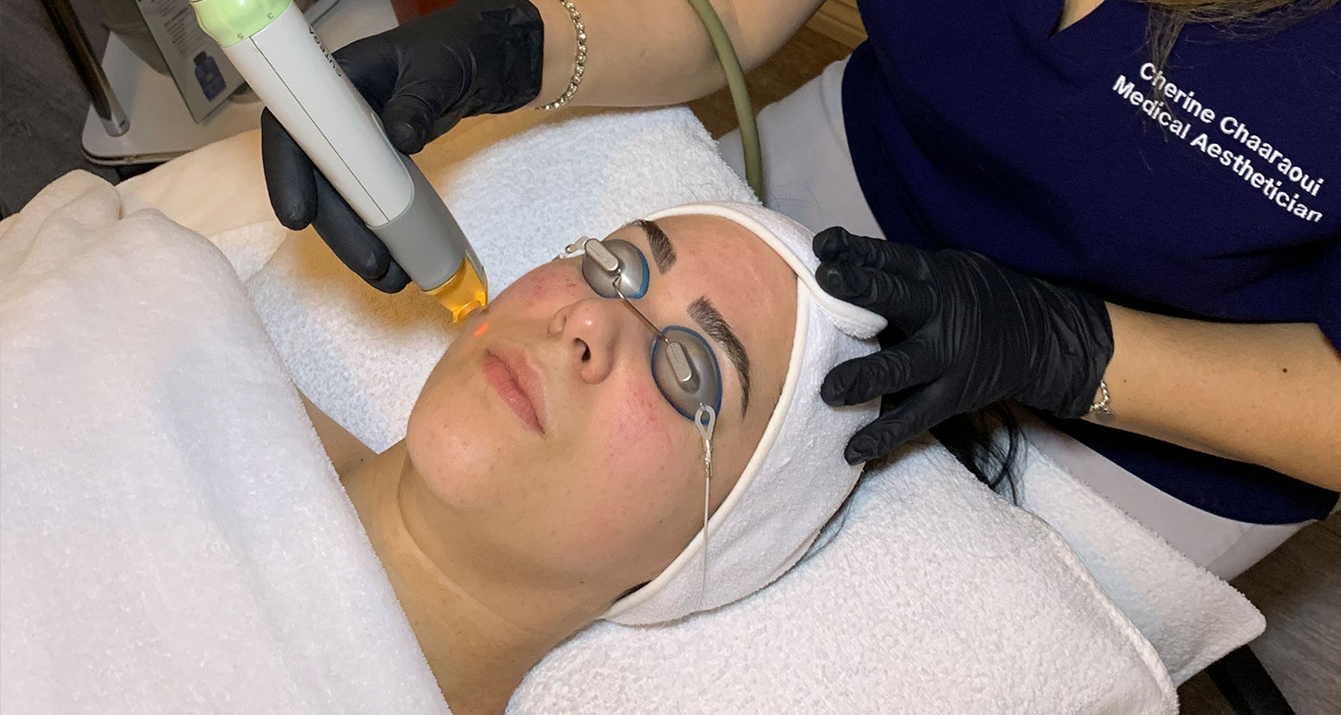 Top Non-Surgical Cosmetic Procedures