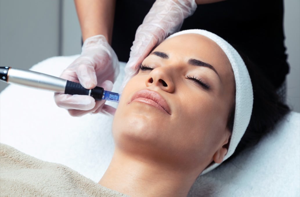 Microneedling with Exosomes in Ottawa