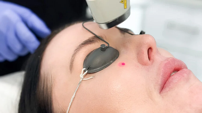 Laser Genesis in Ottawa