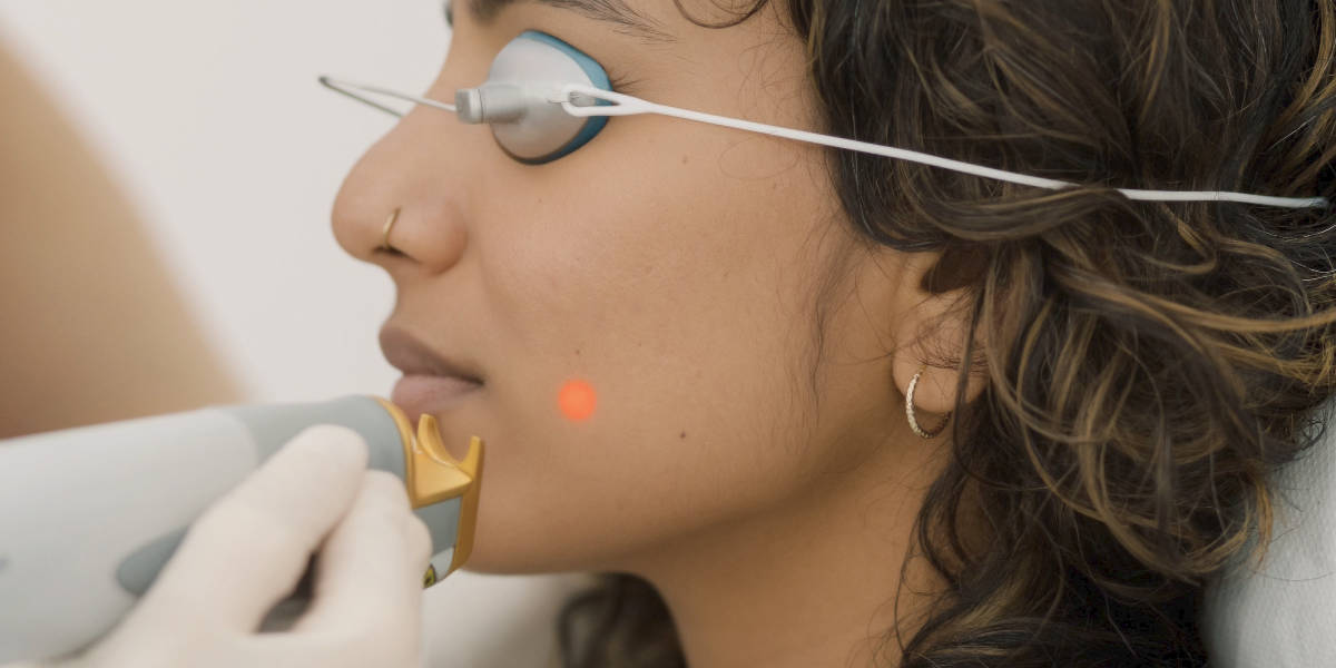 Laser Genesis and Photorejuvenation