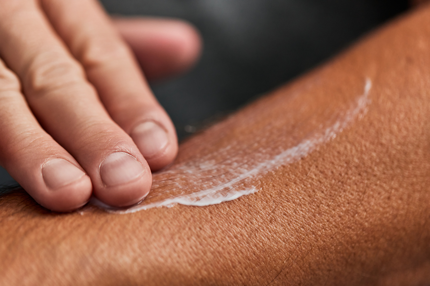 Dry Skin in Ottawa Why It Happens and How to Restore Deep Hydration